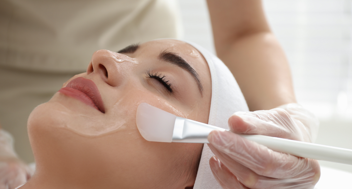 Acne Peels