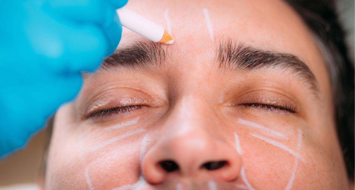 Dermal Fillers