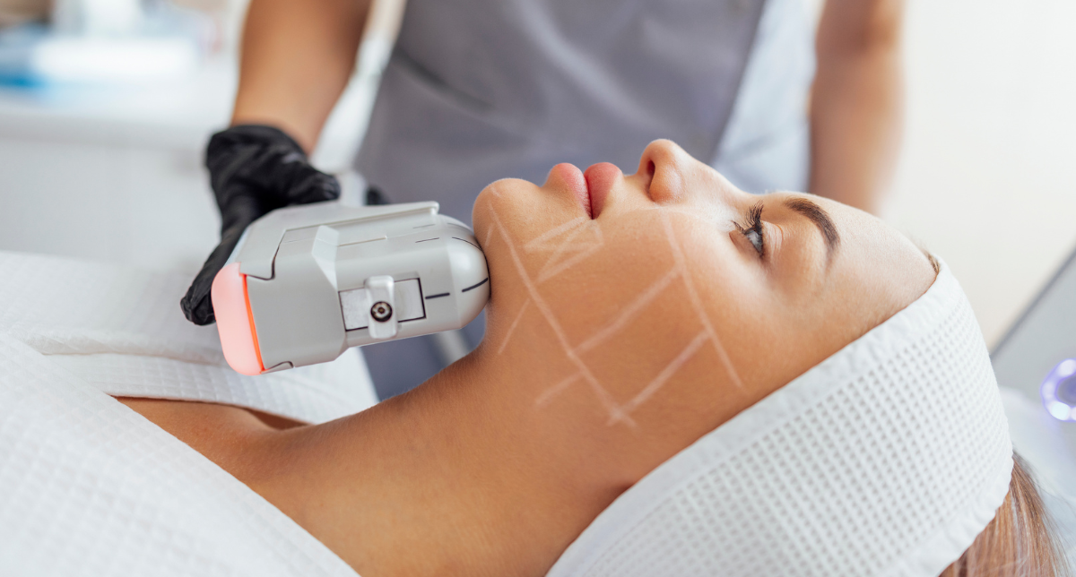 RF Skin Tightening