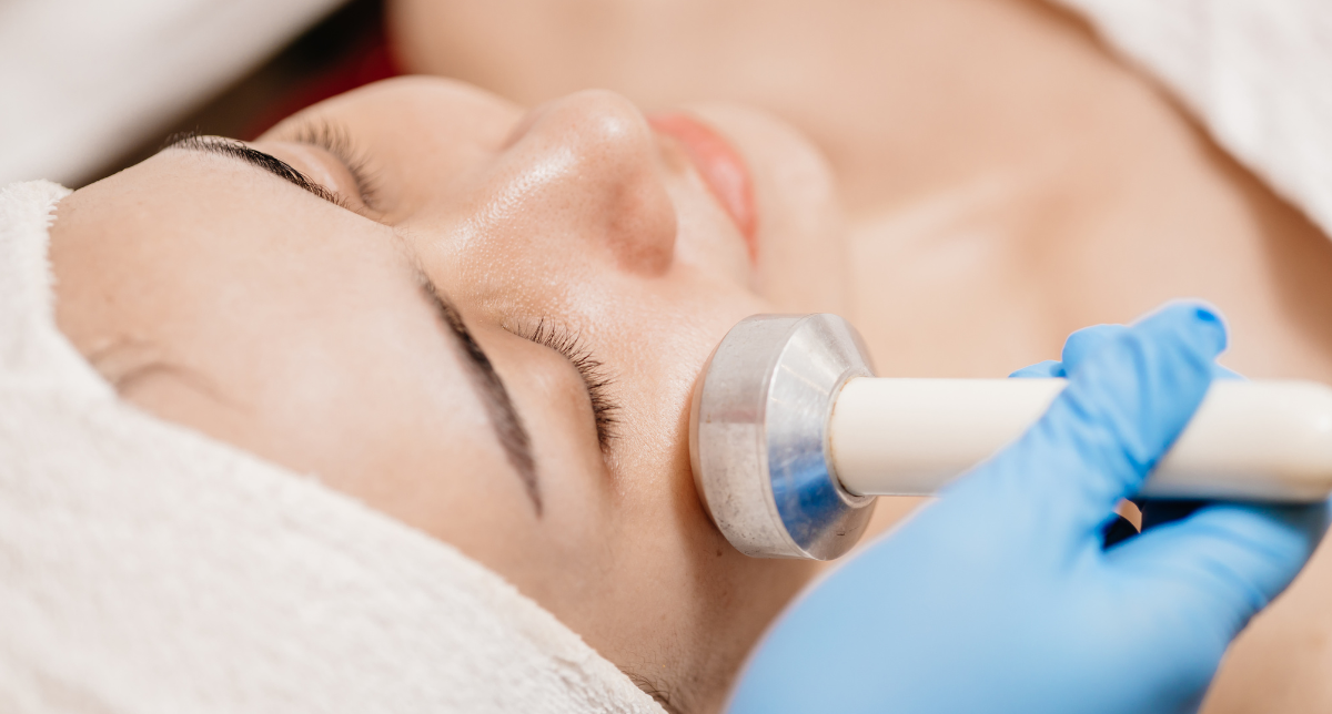 RF Skin Tightening