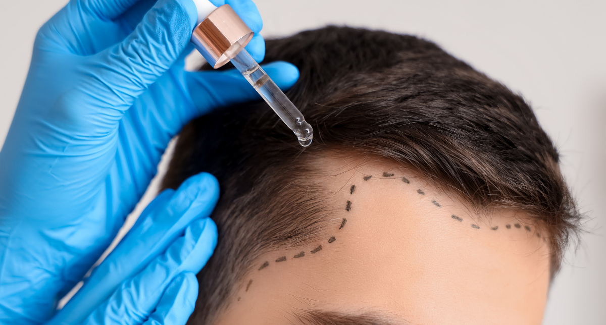 Hair Growth Therapies