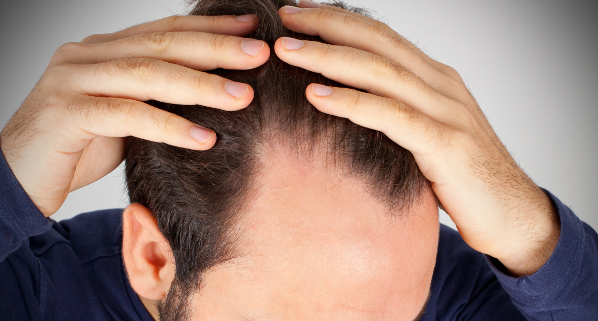 MCT Hair Therapy