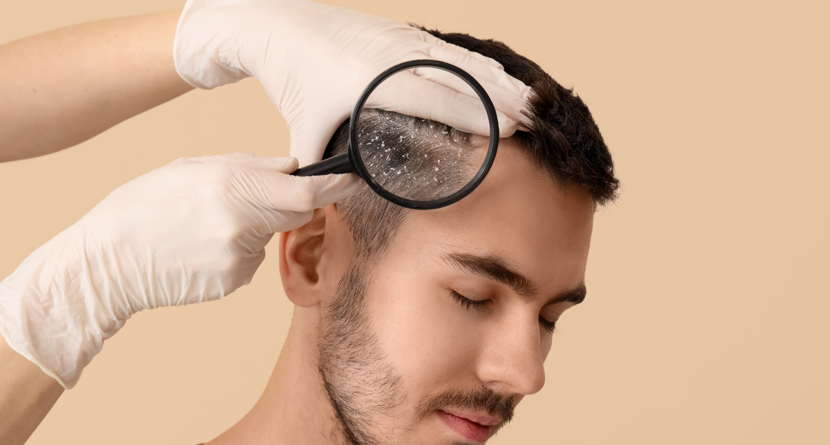 Scalp Treatments
