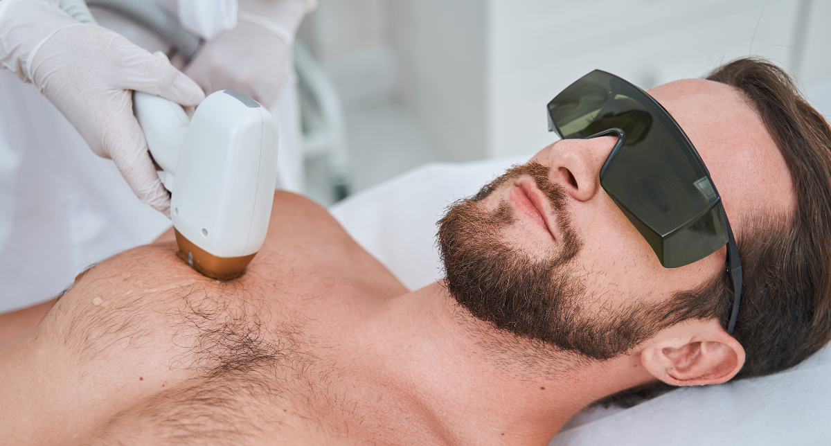Men's Laser Hair Reduction